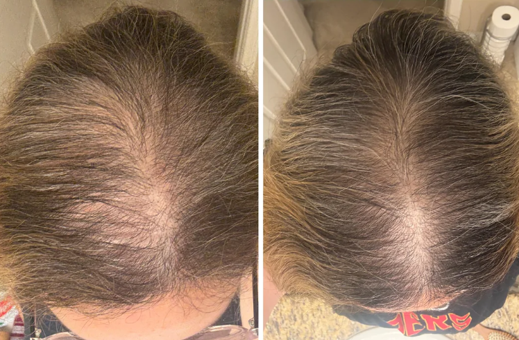 Jessica M., 44 before and after results
