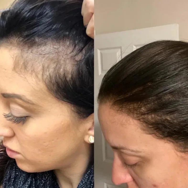 Emma L., 52 años before and after results