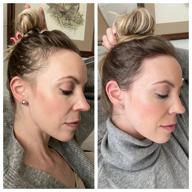 Sarah W., 47 before and after results